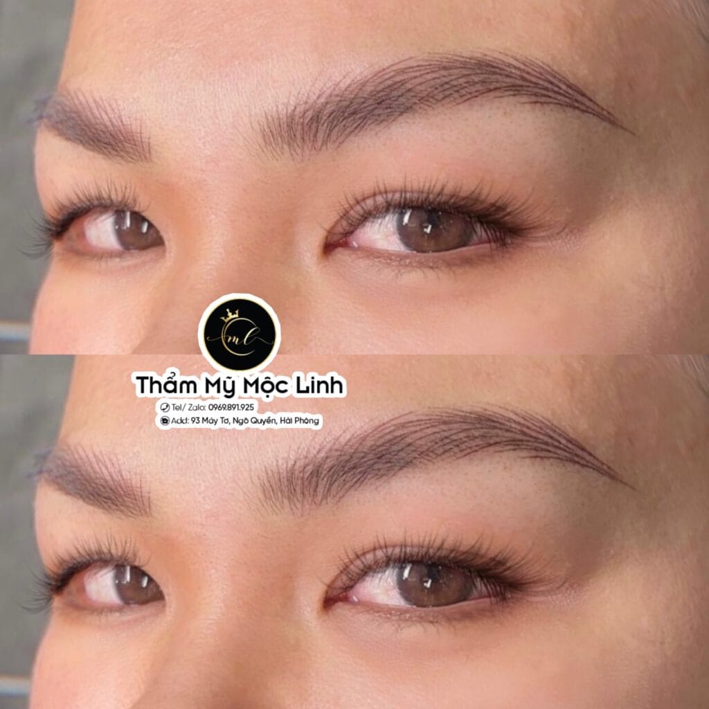 Phun mày tại Thẩm Mỹ Mộc Linh Hải Phòng - hình 6