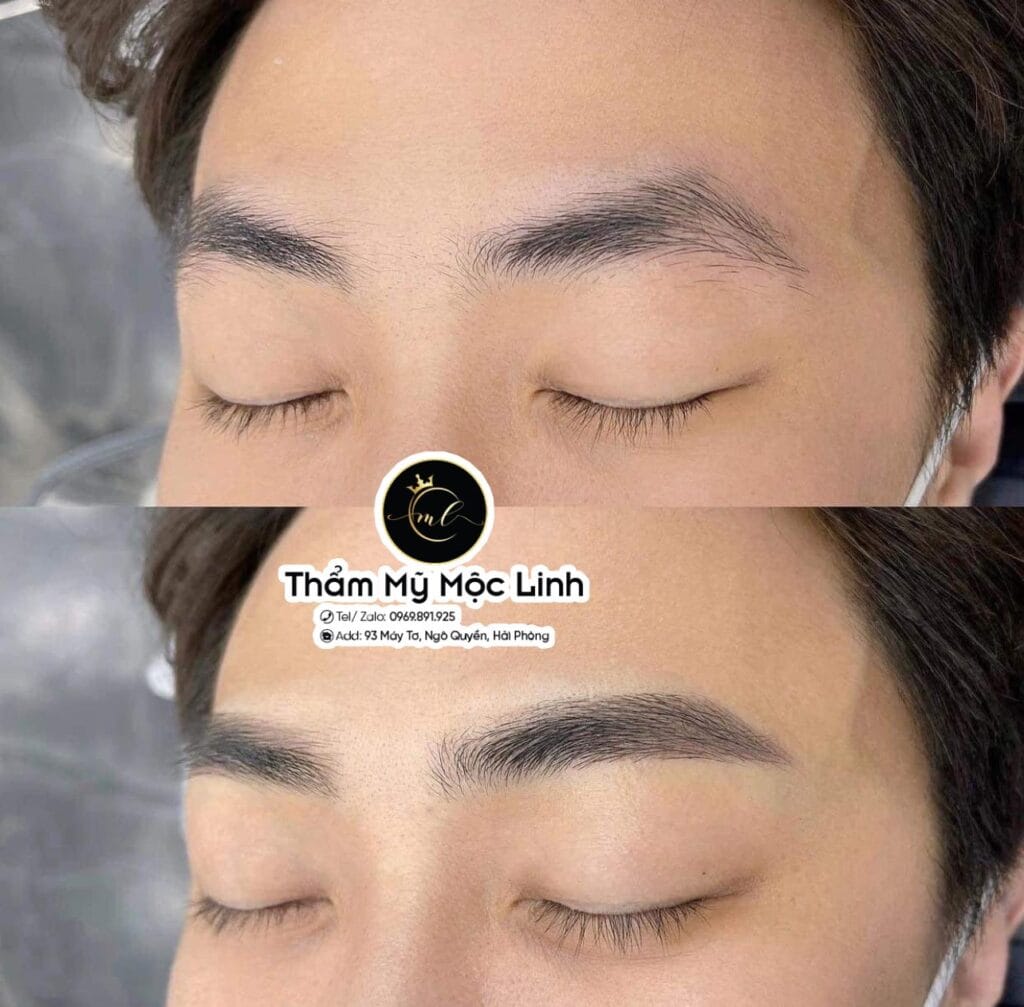 Phun mày tại Thẩm Mỹ Mộc Linh Hải Phòng - hình 5