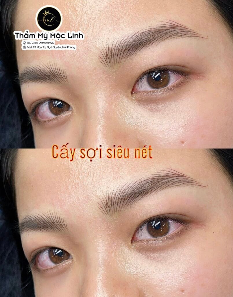 Phun mày tại Thẩm Mỹ Mộc Linh Hải Phòng - hình 1