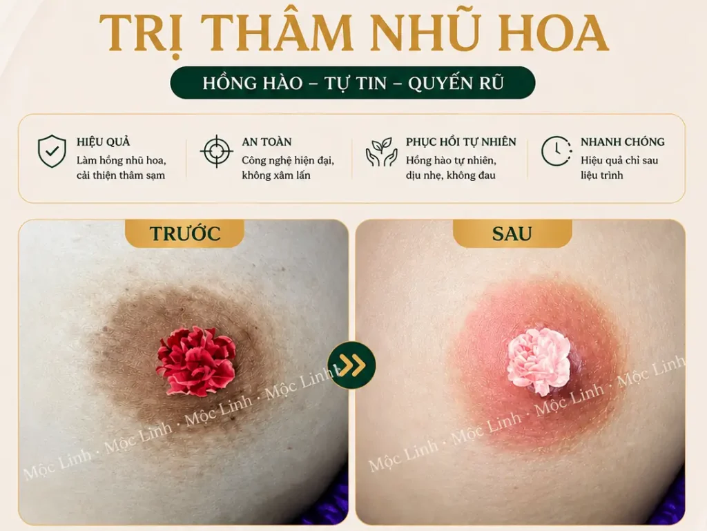 Làm hồng vùng kín bằng laser tại Thẩm Mỹ Mộc Linh Hải Phòng - hình 9