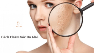 Hướng dẫn cách chăm sóc da khô tại Thẩm Mỹ Mộc Linh Hải Phòng - hình 1