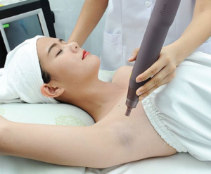 Cách Trị Thâm Nách Đơn Giản, Hiệu Quả Và Nhanh Chóng tại Thẩm Mỹ Mộc Linh Hải Phòng - hình 3