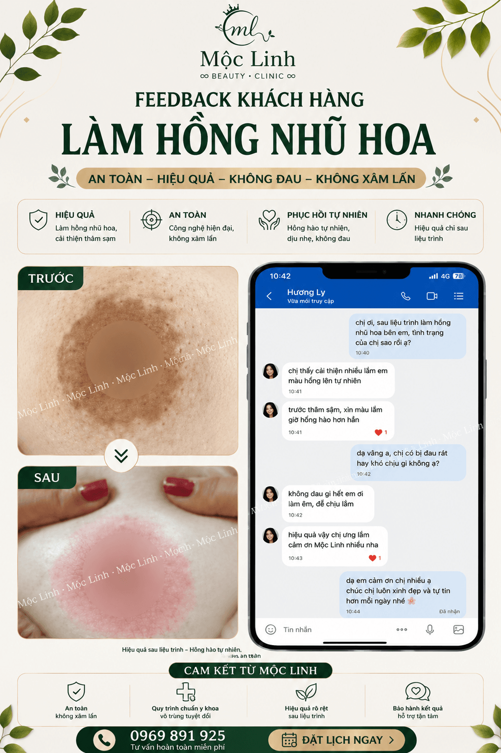 Làm hồng nhũ hoa - vùng kín tại Hải Phòng tại Thẩm Mỹ Mộc Linh - hình 5