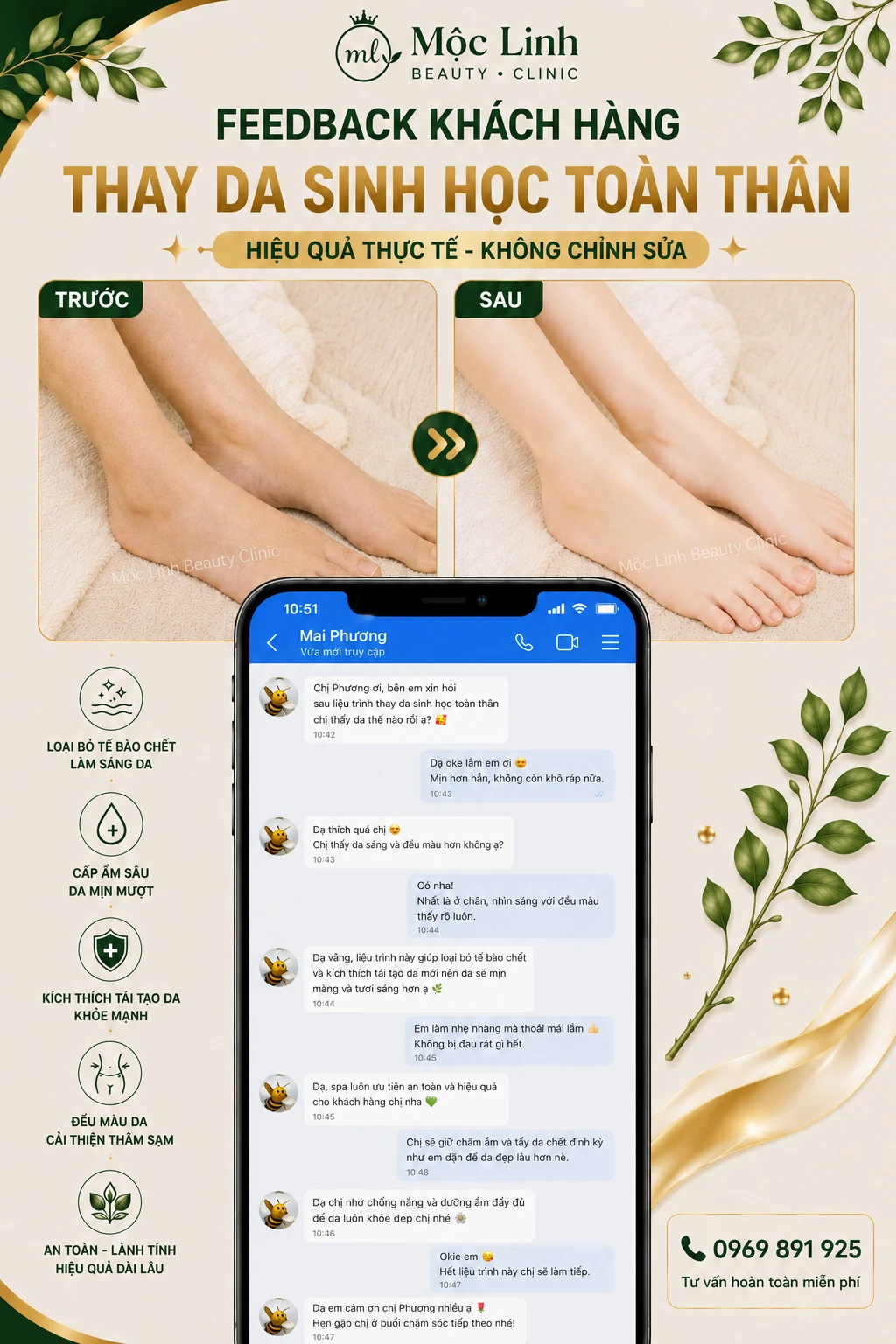 Thay da sinh học công nghệ cao tại Mộc Linh Hải Phòng
