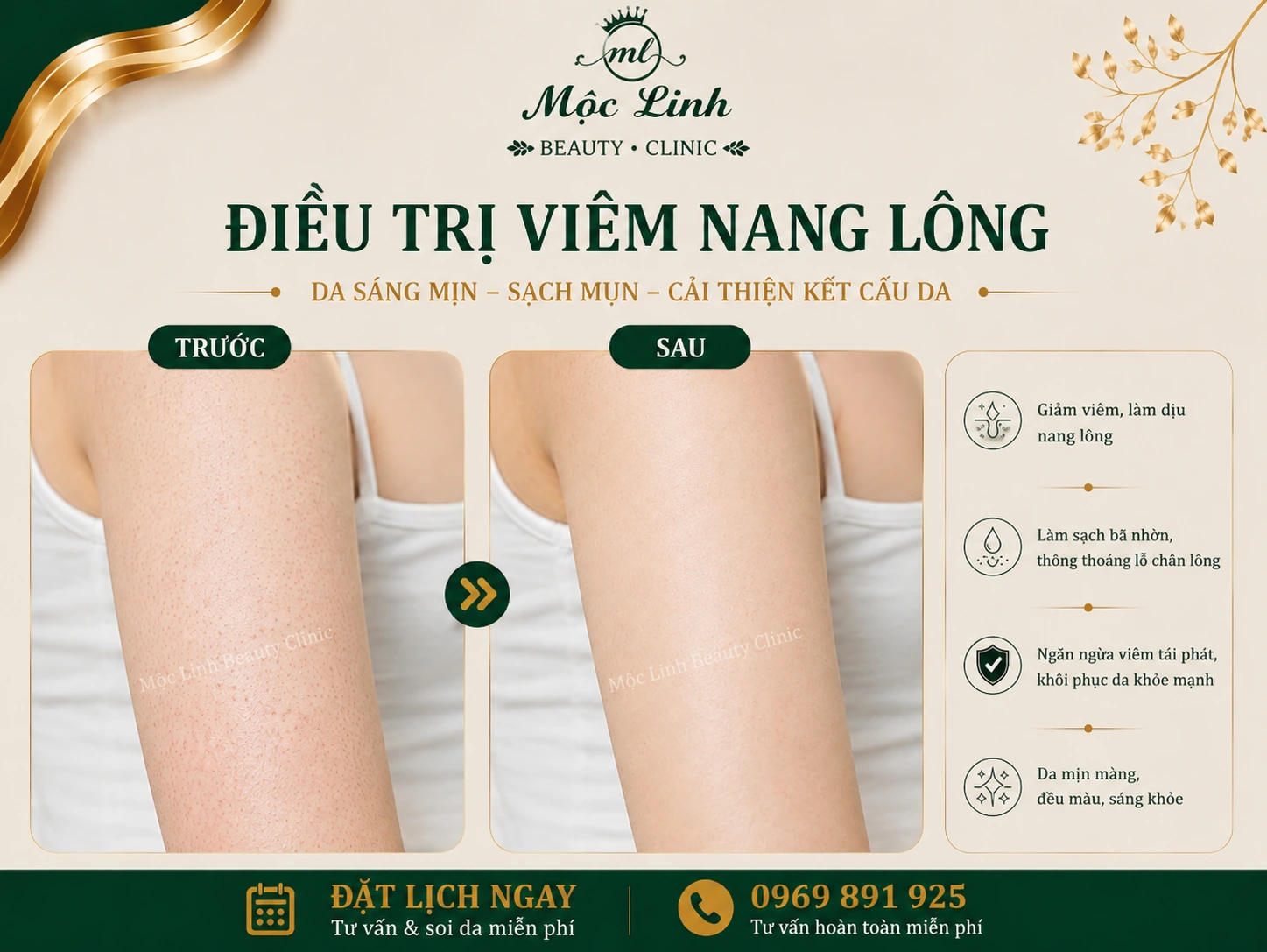 Hình ảnh thực tế dịch vụ điều trị viêm nang lông tại Hải Phòng