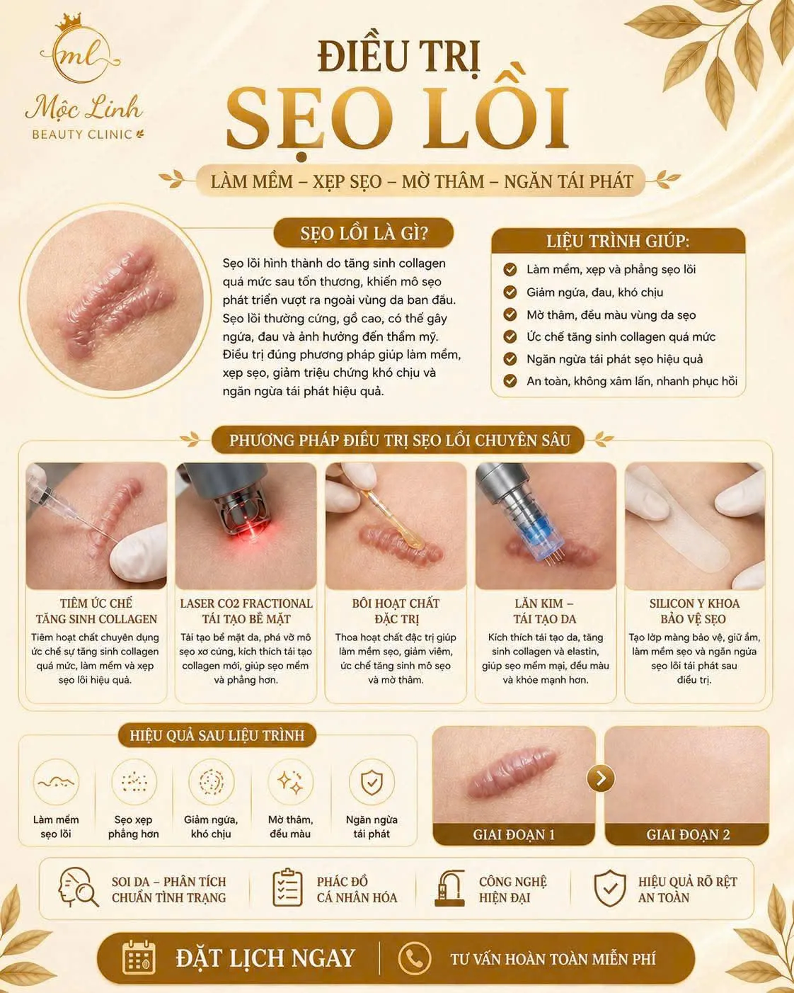 Sau trị mụn kiêng gì để da phục hồi tại Thẩm Mỹ Mộc Linh Hải Phòng