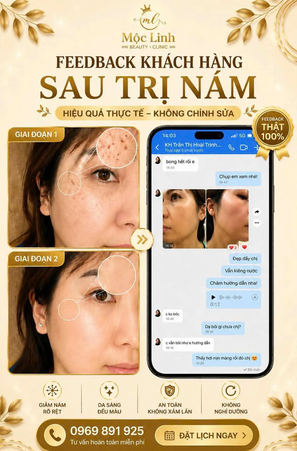 Feedback khách hàng sau điều trị nám thành công tại Hải Phòng